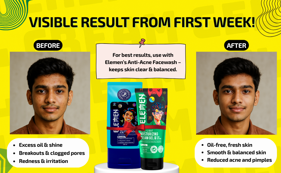 Ultra-Light Moisturizing Cream Gel for Acne Control (75g) with Acnesium and Wild rose berries