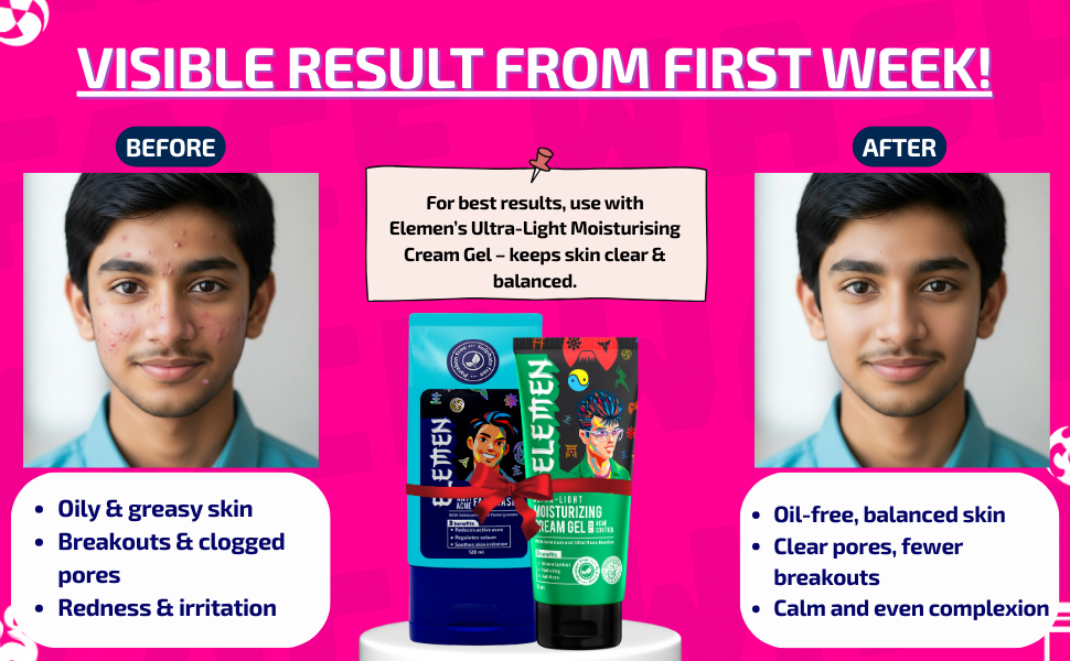 Anti-Acne Facewash (120ml)