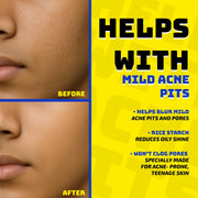 Moisturizing Sunscreen Butter SPF 50+ PA+++ (50g) with Zinc Oxide, Uvinal A plus and Rice starch : Non Greasy for boys